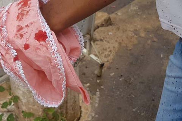 Moradores em pânico: atiradores abrem fogo e deixam criança e garoto feridos na cidade