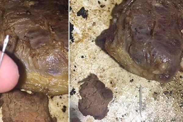 Consumidor é surpreendido em Patos de Minas com pedaço de agulha em carne de churrasco