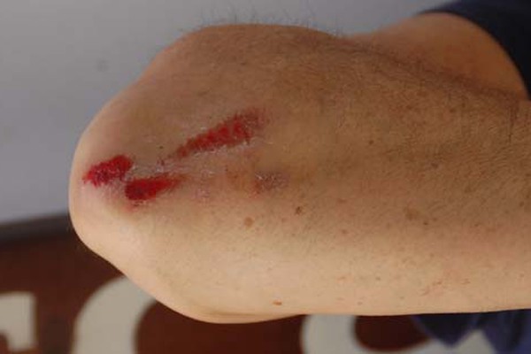 Proteção divina: vítima fica ferida, mas jovem é preso e material recuperado após assalto