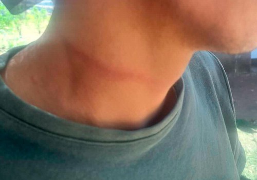Homem é preso por sequestrar e amarrar ex-funcionário que teria furtado seu dinheiro em Patos de Minas