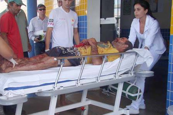 Acidente com ensiladeira deixa operário gravemente ferido perto de PO
