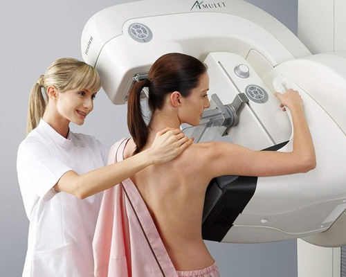 Mulheres poderão fazer mamografia em Patos de Minas sem agendamento