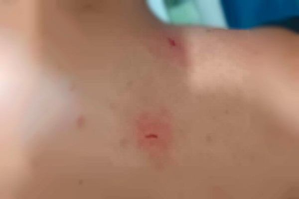 Jovem é preso por quebrar celular e agredir companheira com faca em Patos de Minas